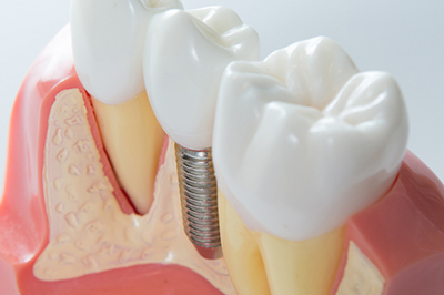 オアシスデンタルメンテナンス